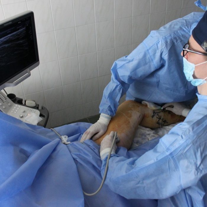 Хирургические вмешательства2